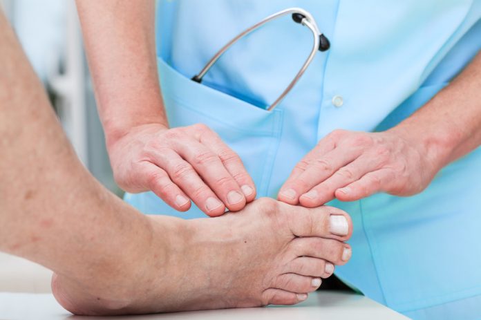 4 Quick Tips on Relieving Bunion Pain