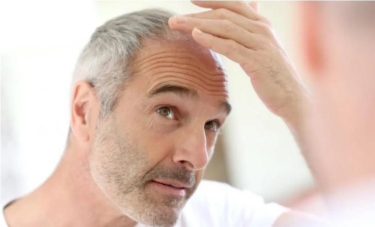 hair loss typically occurs